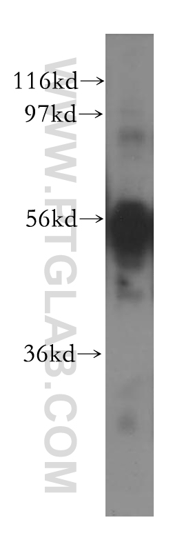 CXADR Polyclonal antibody