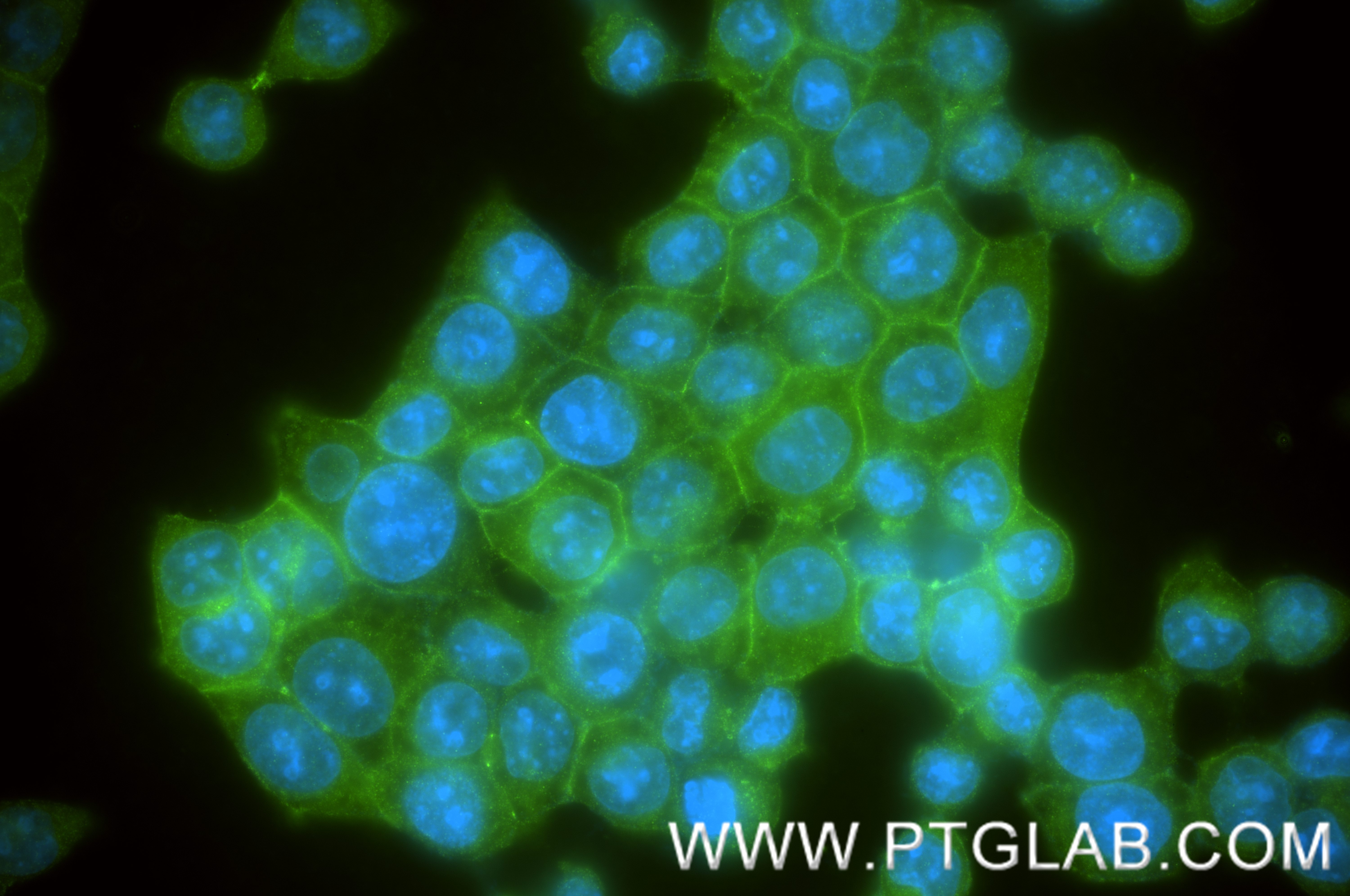IF Staining of BxPC-3 using 86186-1-RR