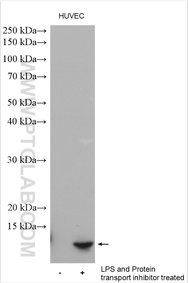 WB analysis using 12335-1-AP