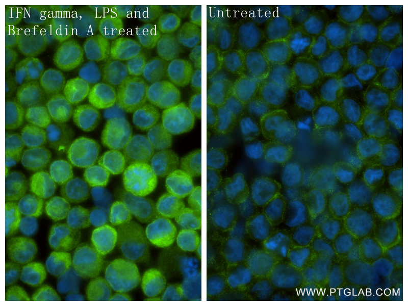 IF Staining of THP-1 using 85307-1-RR (same clone as 85307-1-PBS)