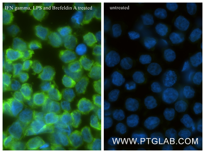 IF Staining of THP-1 using 85307-1-RR