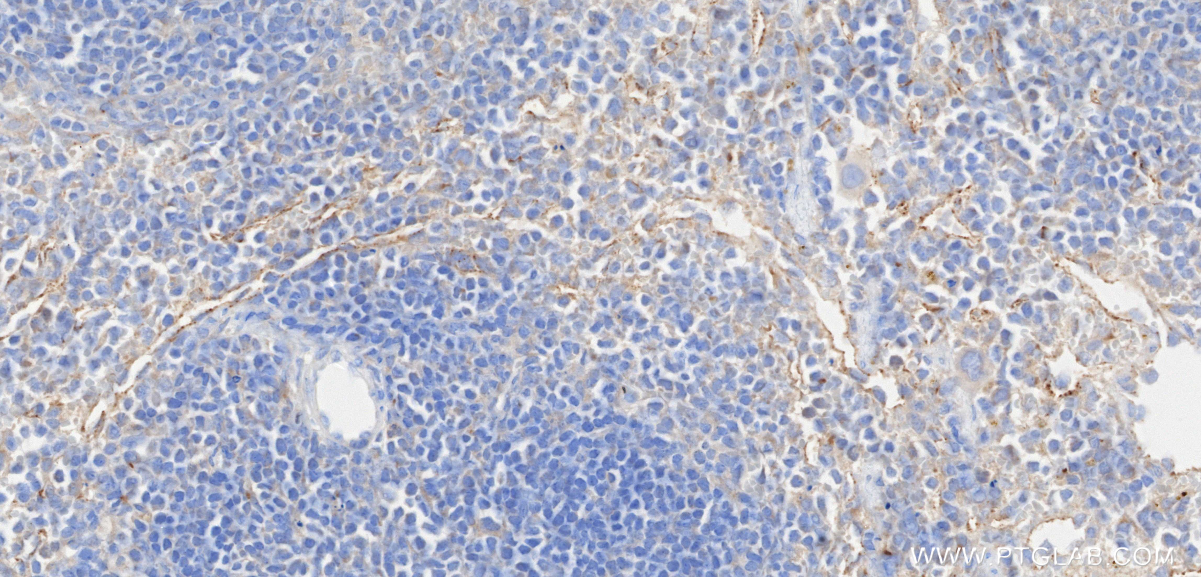 IHC staining of mouse spleen using 87669-1-RR (same clone as 87669-1-PBS)