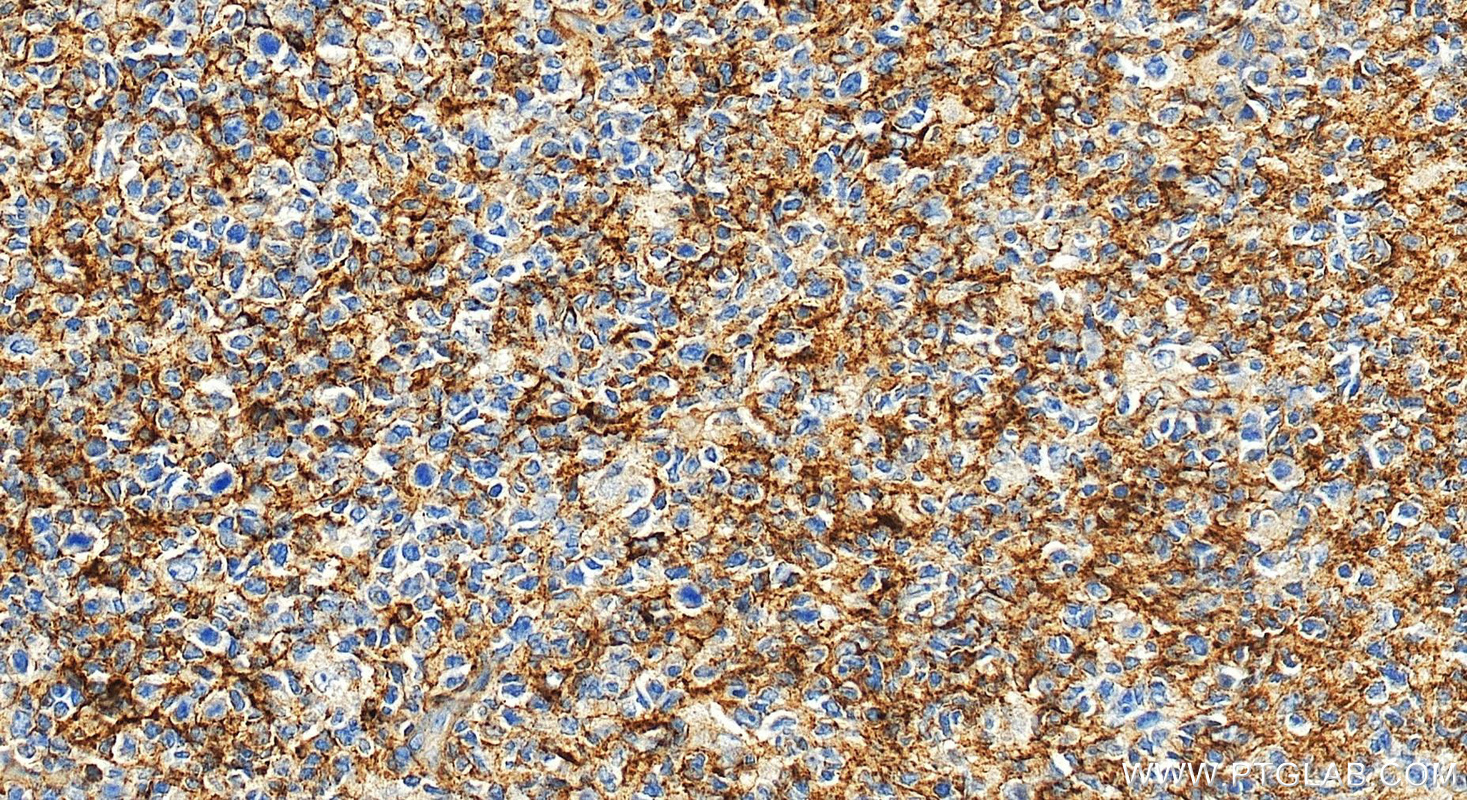 IHC staining of human tonsillitis using 10927-1-AP