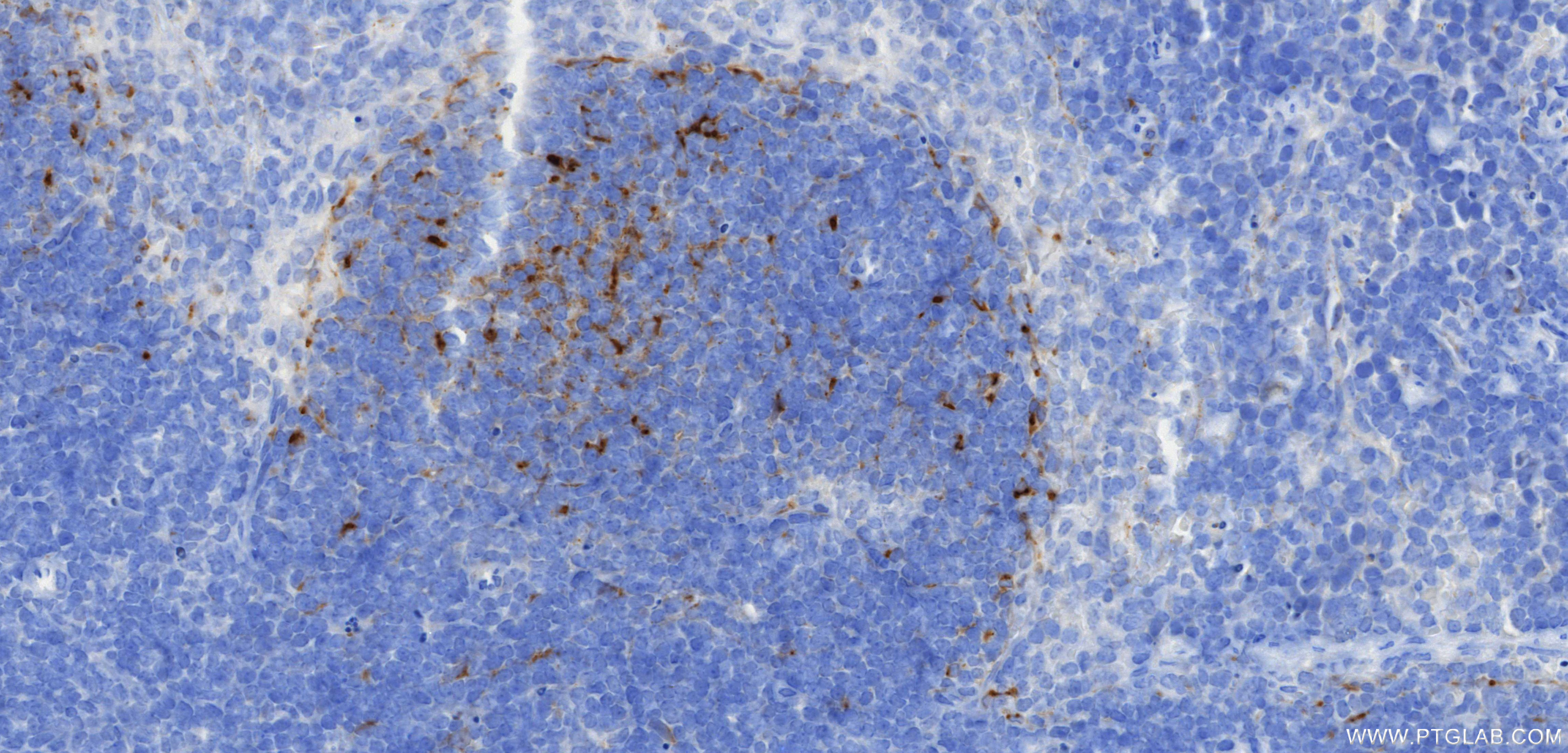 IHC staining of mouse spleen using 98562-1-RR (same clone as 98562-1-PBS)