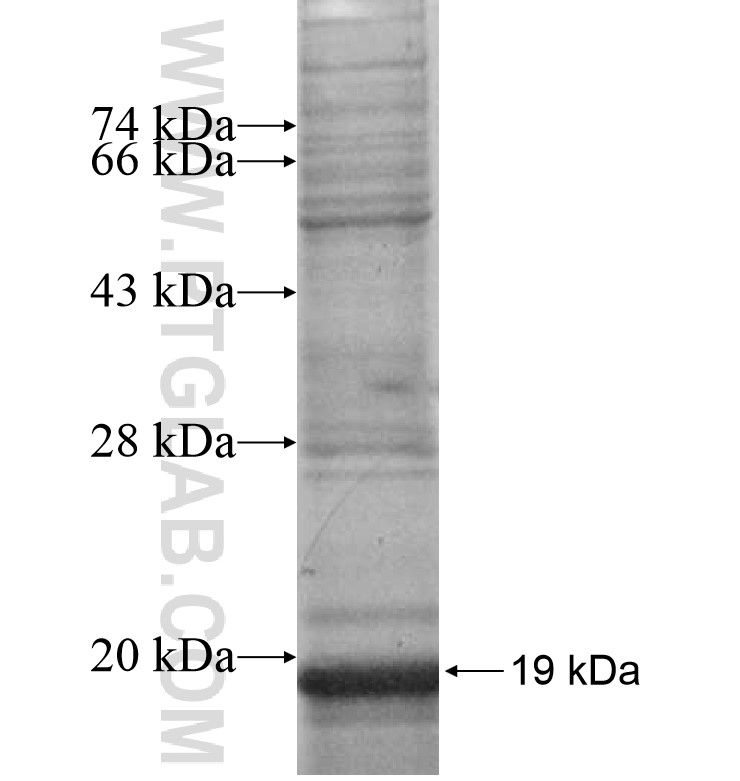 CXCL13 fusion protein Ag16801 SDS-PAGE CXCL13 fusion protein Ag16801 SDS-PAGE