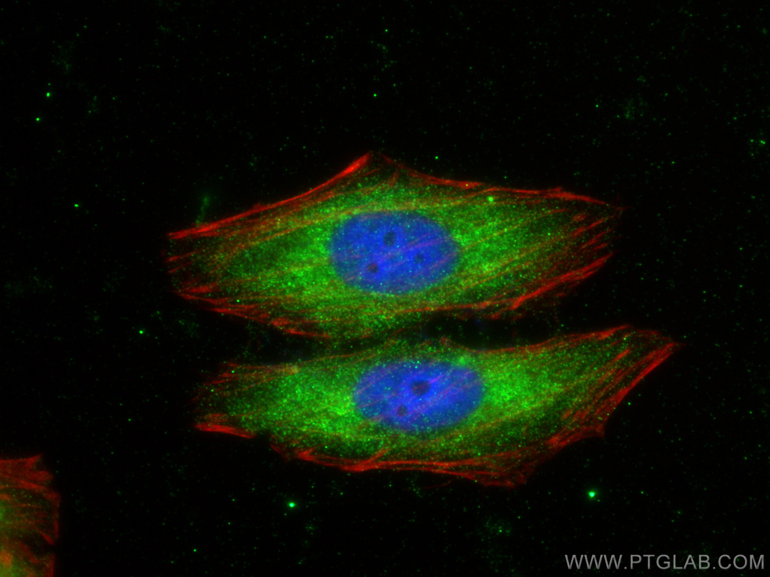 IF Staining of HepG2 using 10468-1-AP