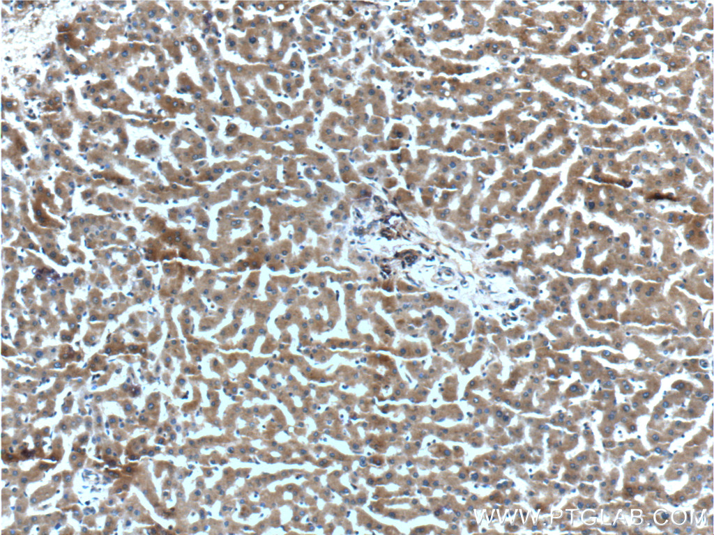 IHC staining of human liver using 10468-1-AP