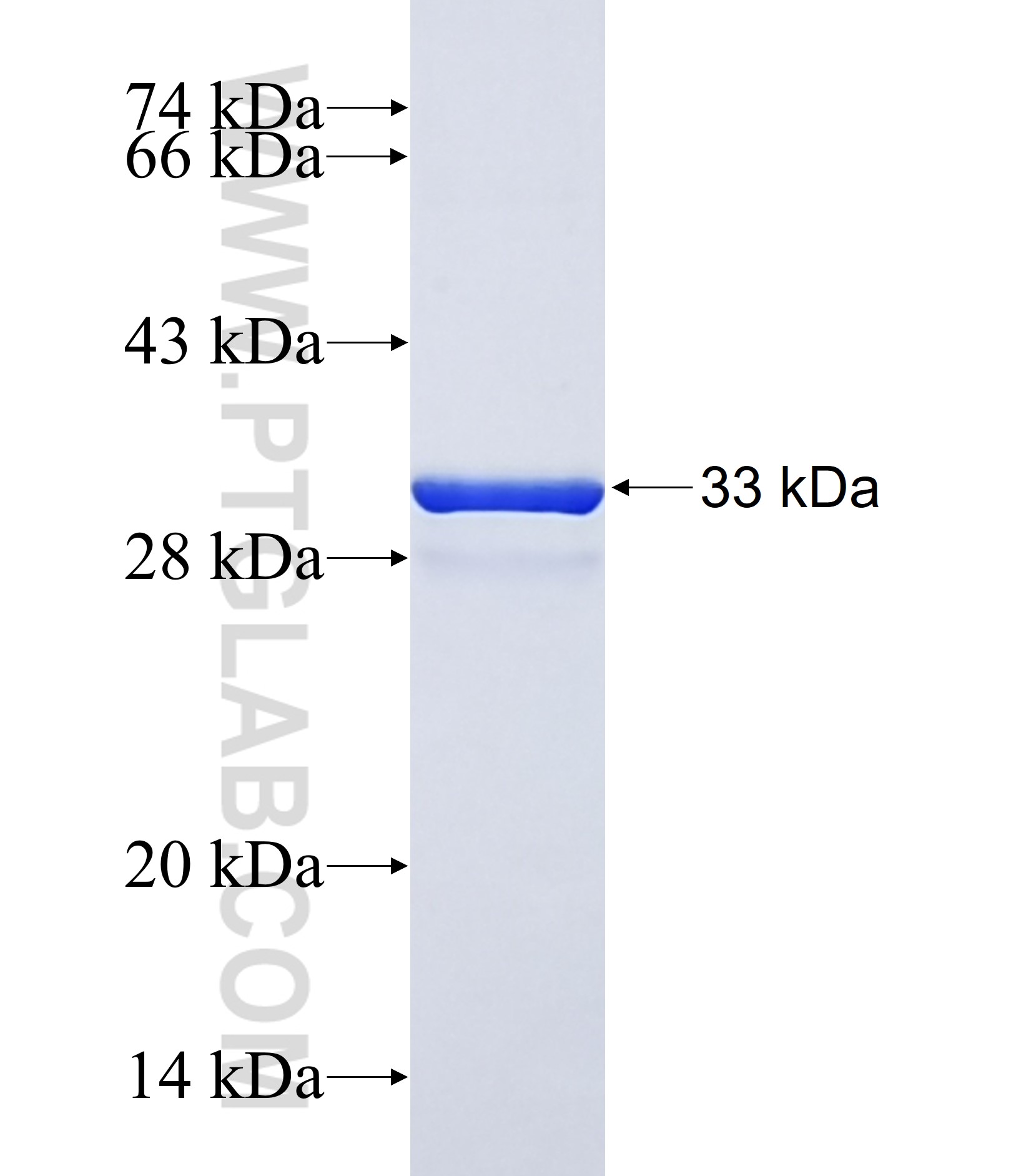 CXCL2 fusion protein Ag25362 SDS-PAGE CXCL2 fusion protein Ag25362 SDS-PAGE