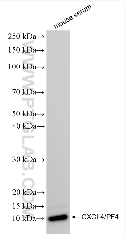 WB analysis of mouse serum using 85647-1-RR (same clone as 85647-1-PBS)