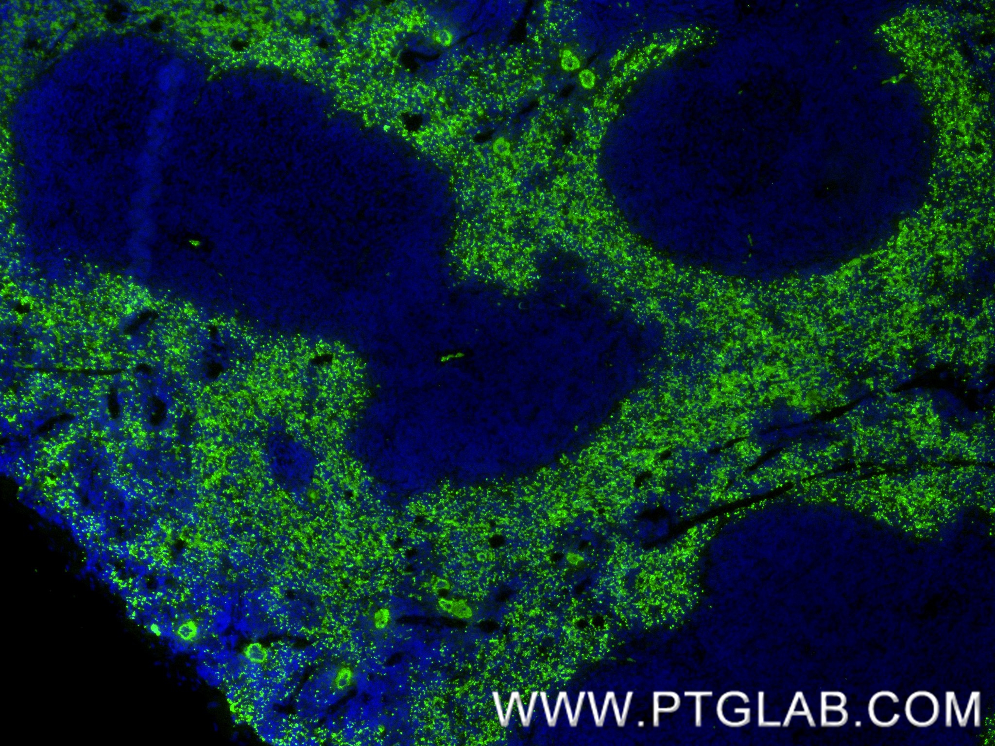 IF Staining of mouse spleen using 85738-1-RR
