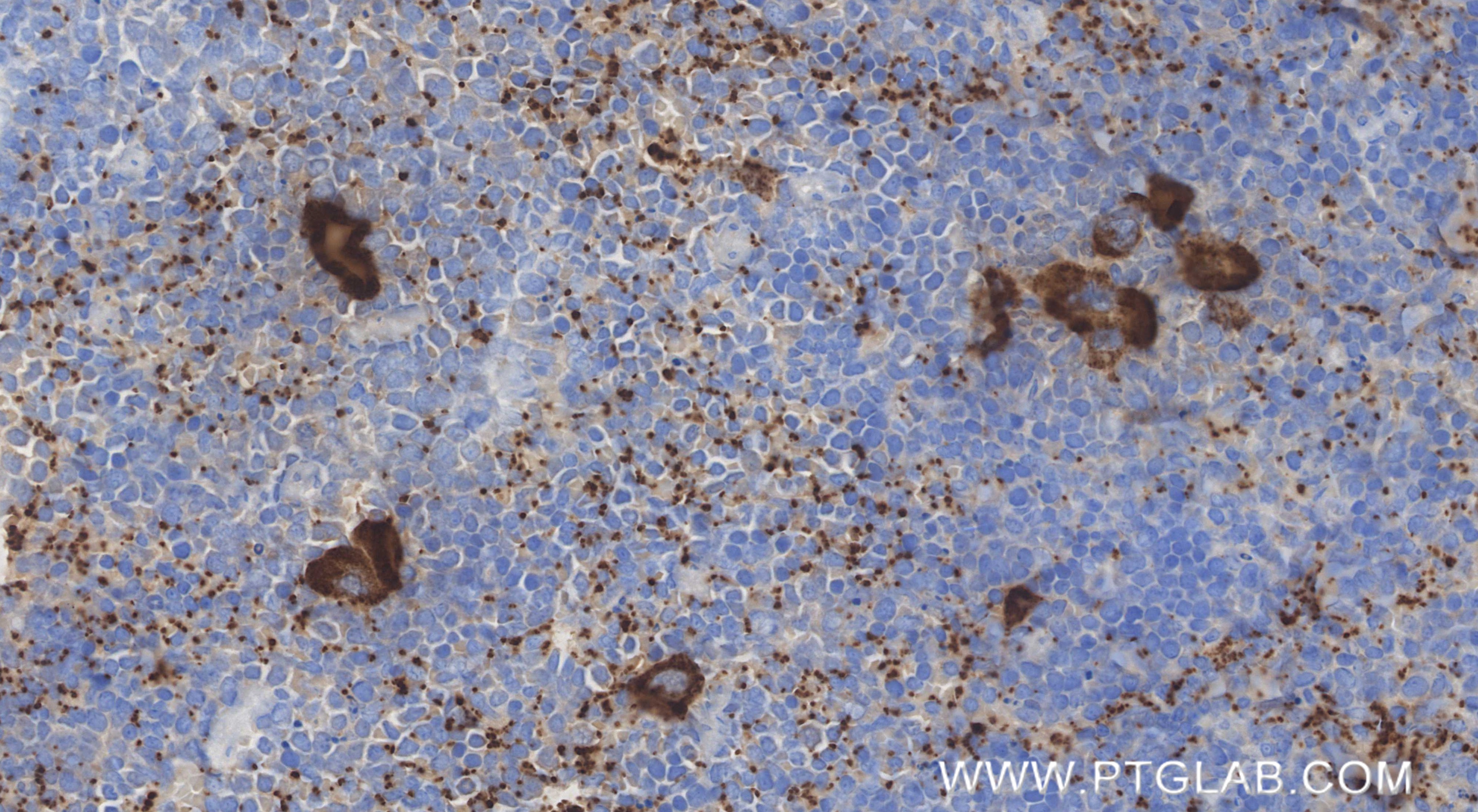 IHC staining of mouse spleen using 85738-1-RR