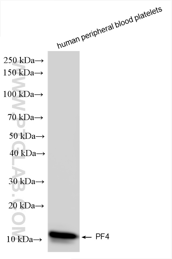 WB analysis of human peripheral blood platelets using 85738-1-RR