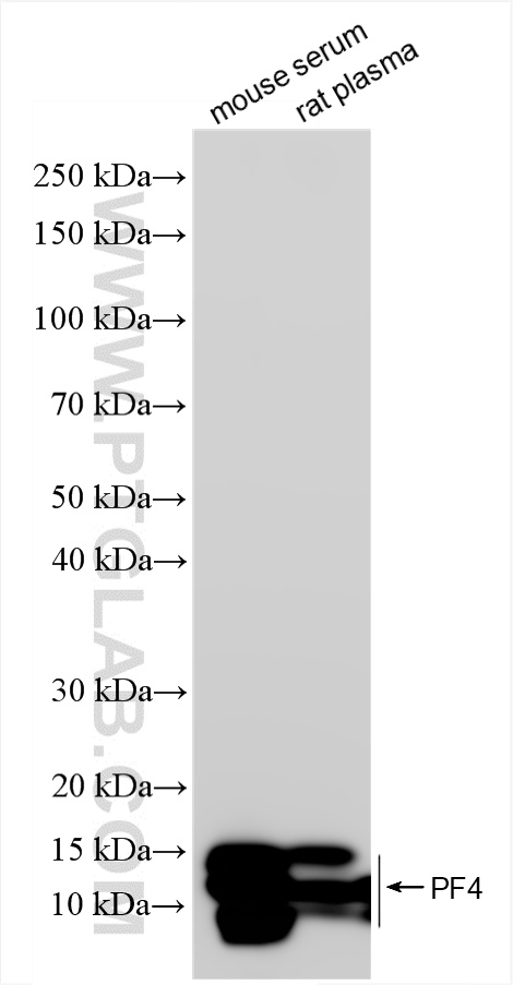 WB analysis using 85738-1-RR