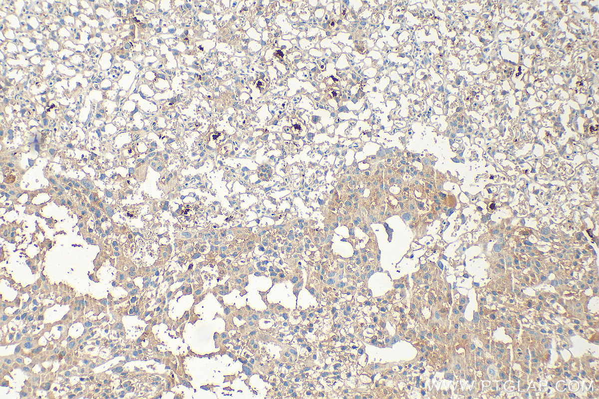 IHC staining of mouse placenta using 33296-1-AP IHC staining of mouse placenta using 33296-1-AP
