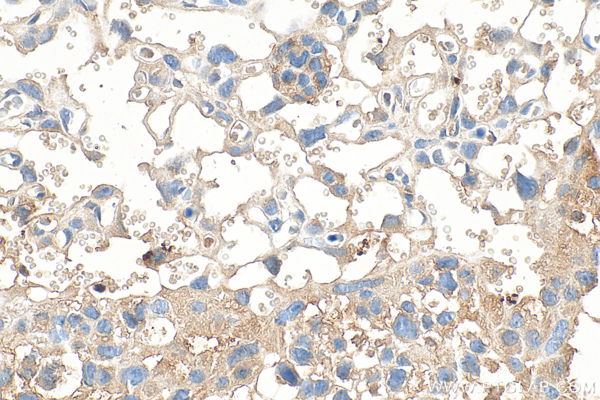 IHC staining of mouse placenta using 33296-1-AP IHC staining of mouse placenta using 33296-1-AP