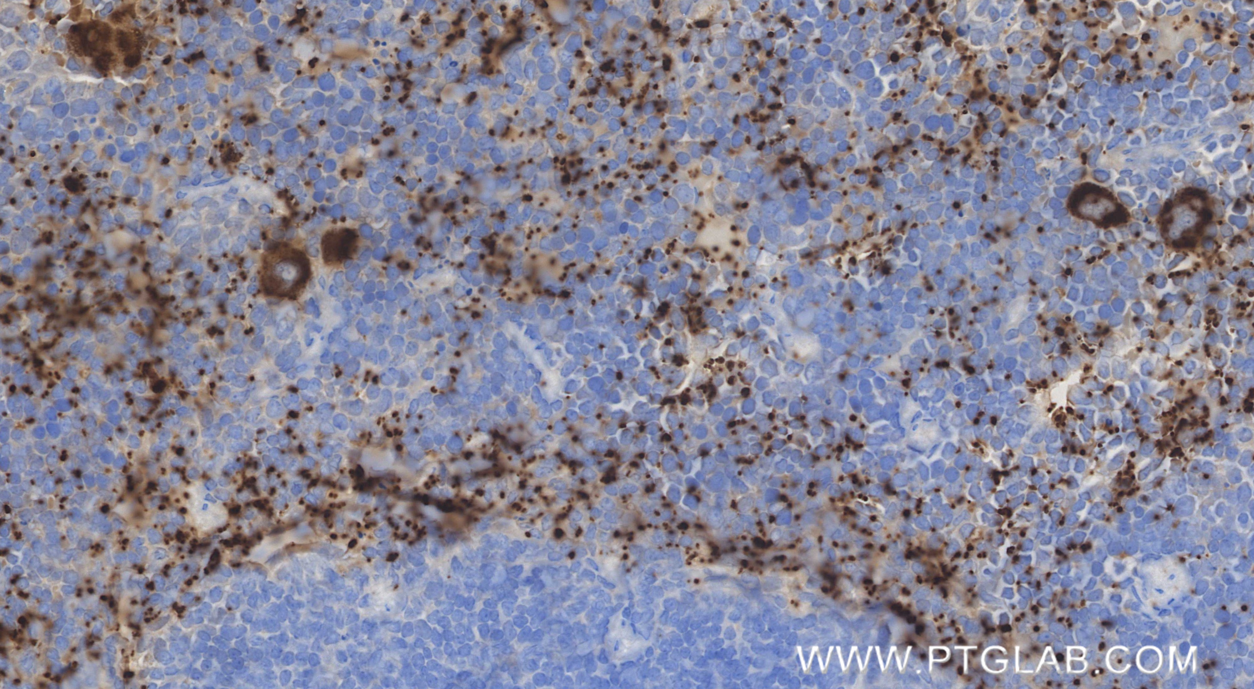 Immunohistochemical analysis of paraffin-embedded mouse spleen tissue slide using 86907-3-RR (CXCL7/PPBP antibody) at dilution of 1:5000 (under 40x lens). Heat mediated antigen retrieval with Tris-EDTA buffer (pH 9.0). IHC staining of mouse spleen using 86907-3-RR