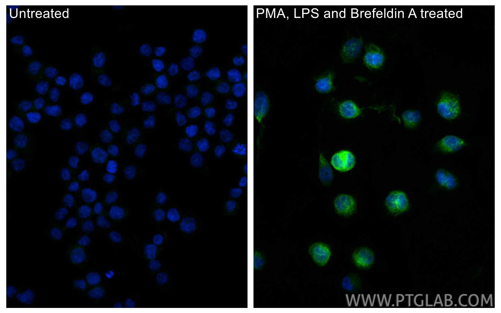 IF Staining of THP-1 using 31533-1-AP