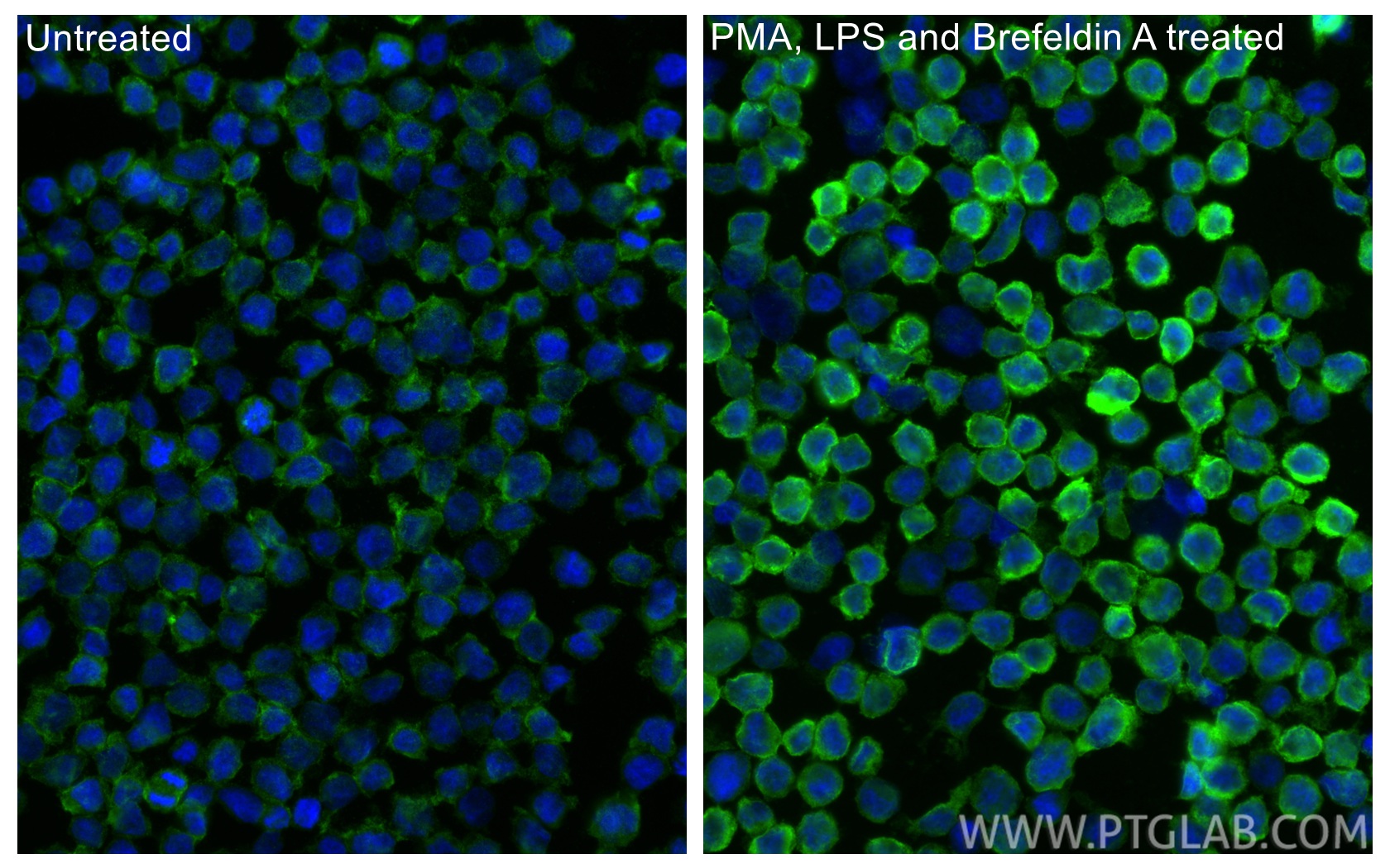 Immunofluorescent analysis of (4% PFA) fixed PMA, LPS and Brefeldin A treated THP-1 cells using CXCL8/IL-8 antibody (27095-1-AP) at dilution of 1:200 and CoraLite®488-Conjugated Goat Anti-Rabbit IgG(H+L) (<a class='green' href='/productredirect?CatalogNo=SA00013-2' target='_blank'>SA00013-2</a>). IF Staining of THP-1 using 27095-1-AP