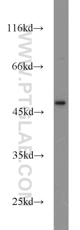 CXCR1 Polyclonal antibody