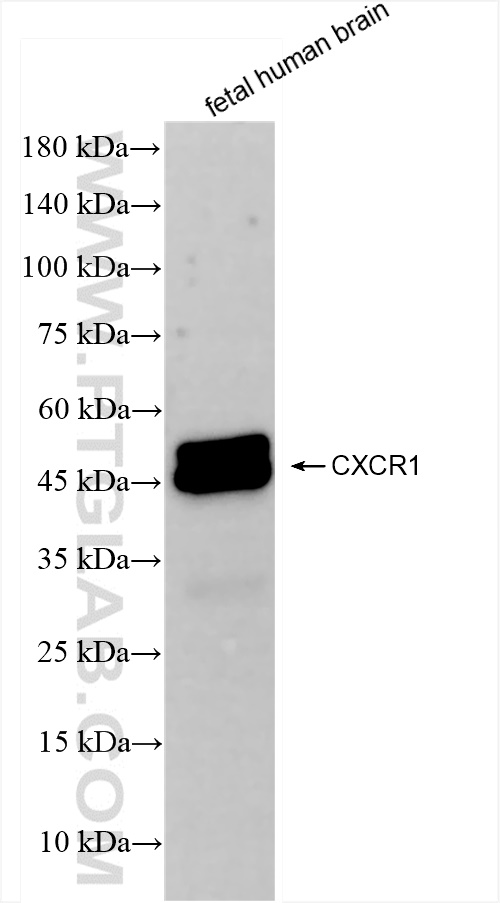WB analysis of fetal human brain using 83801-4-RR