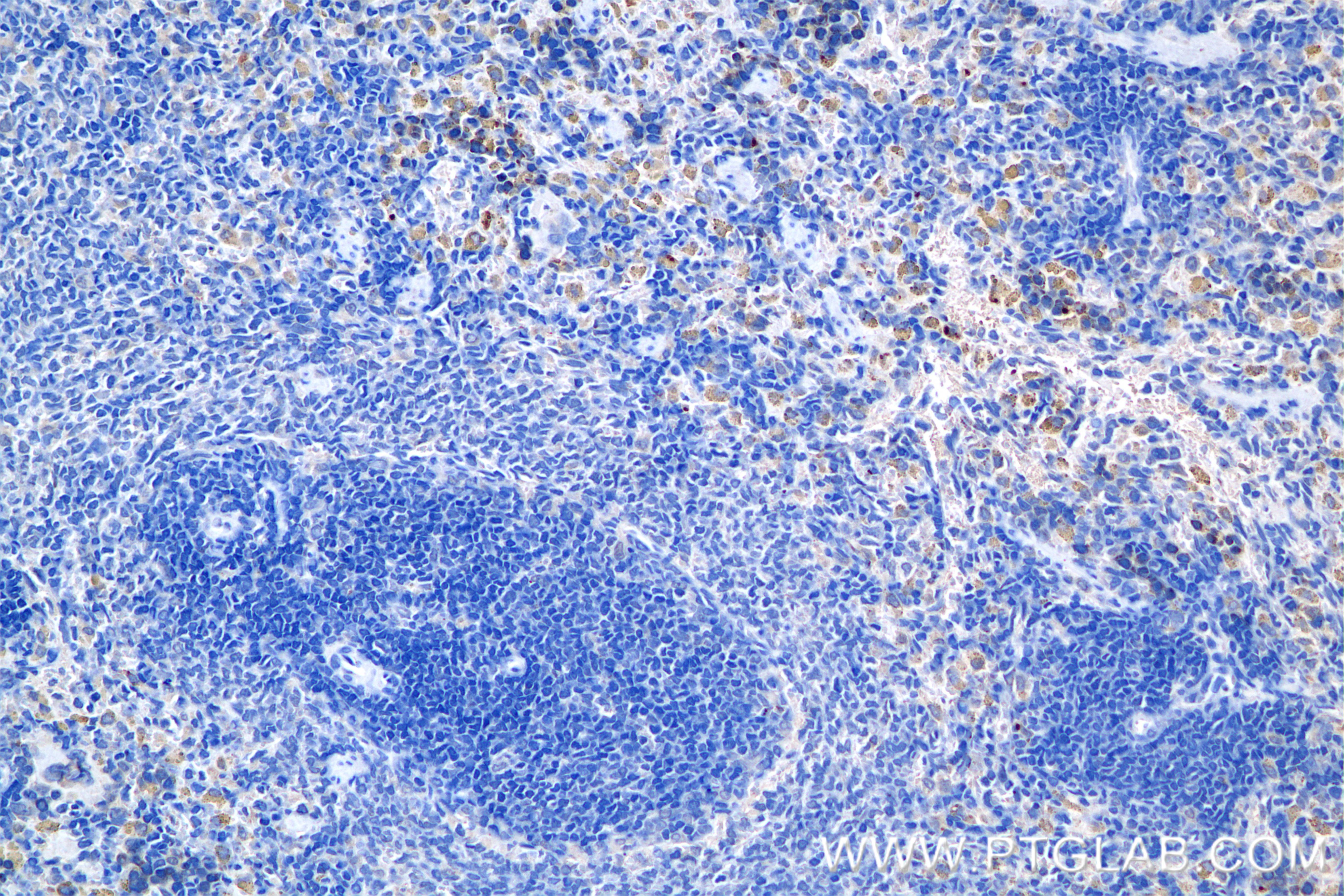 IHC staining of rat spleen using 85144-5-RR