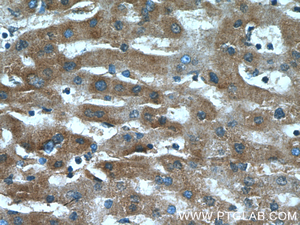 IHC staining of human liver using 26756-1-AP