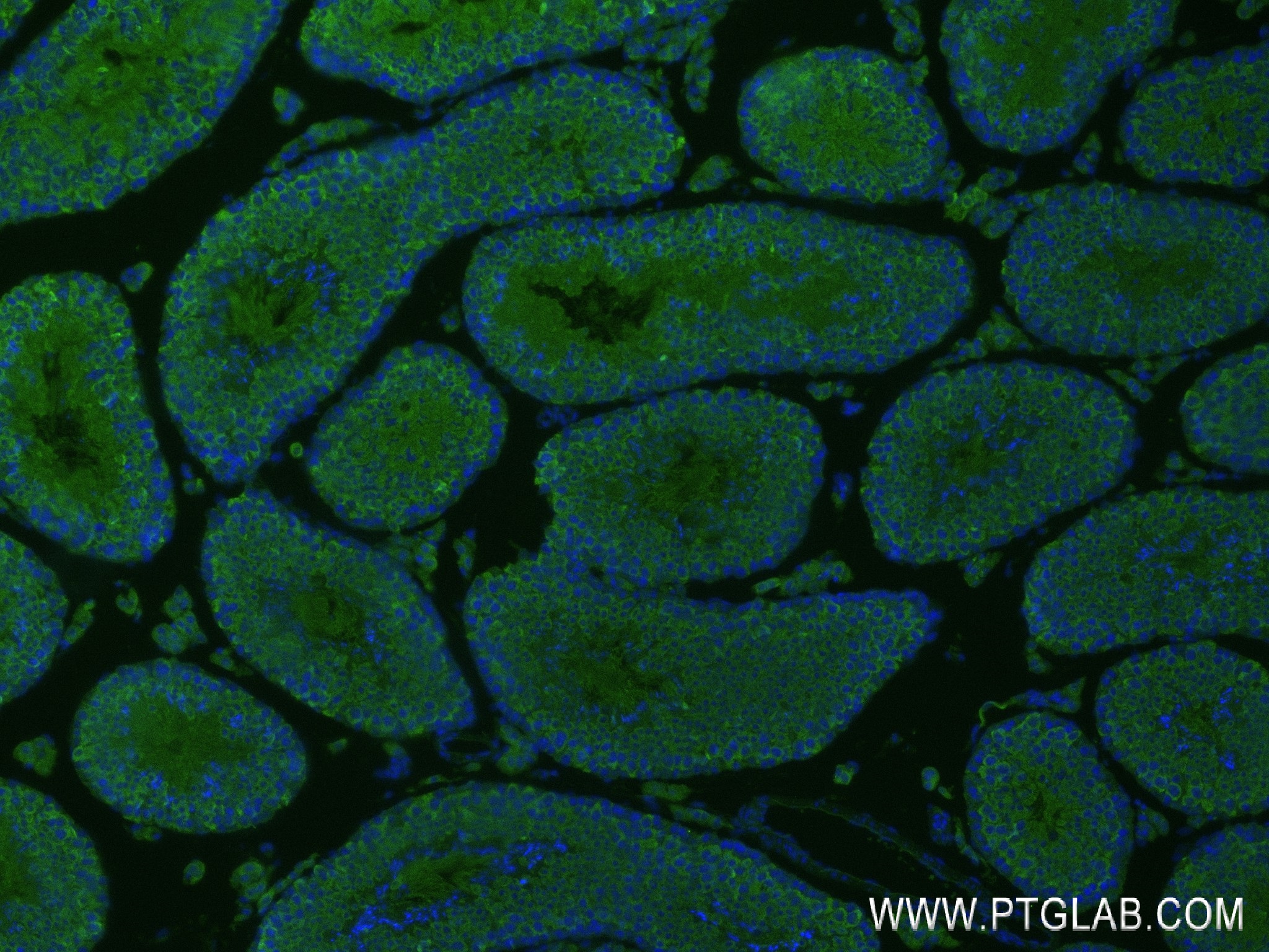 IF Staining of mouse testis using 84904-1-RR