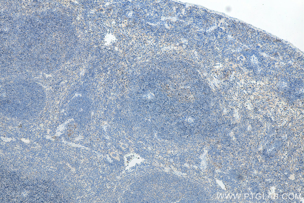 IHC staining of mouse spleen using Biotin-11073