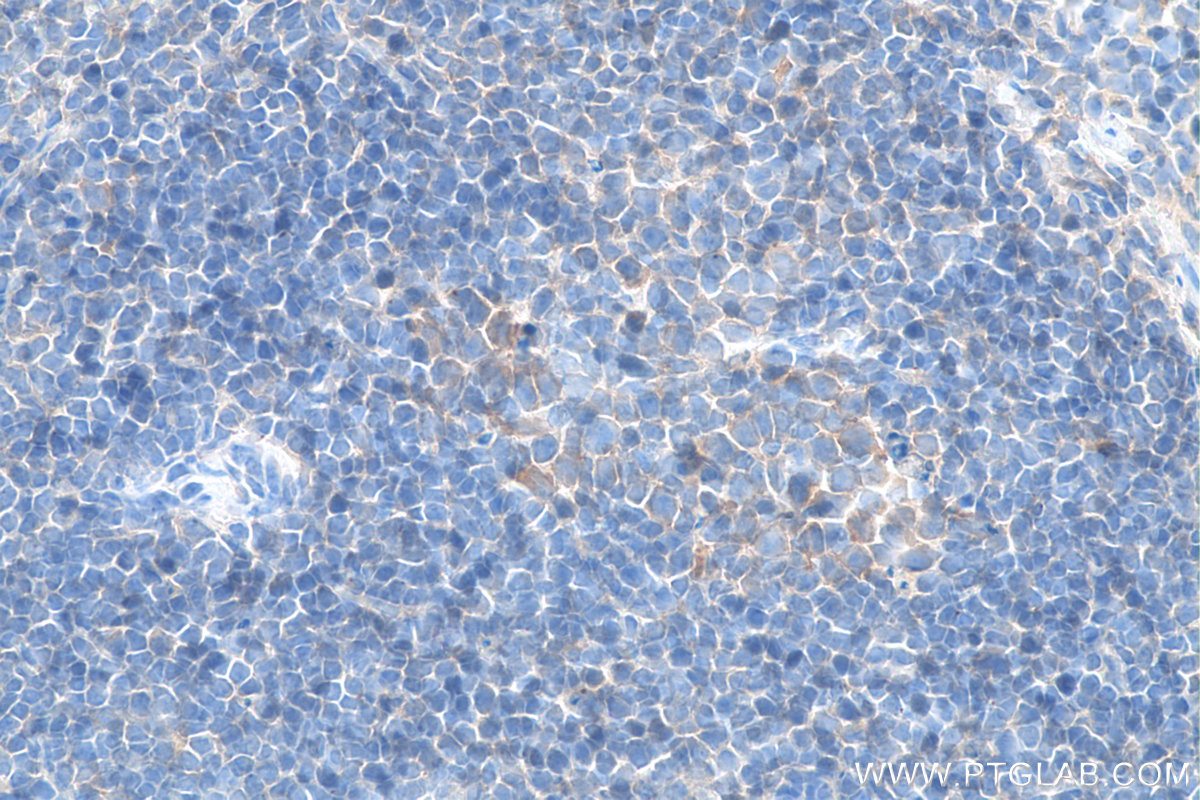 IHC staining of mouse spleen using Biotin-11073