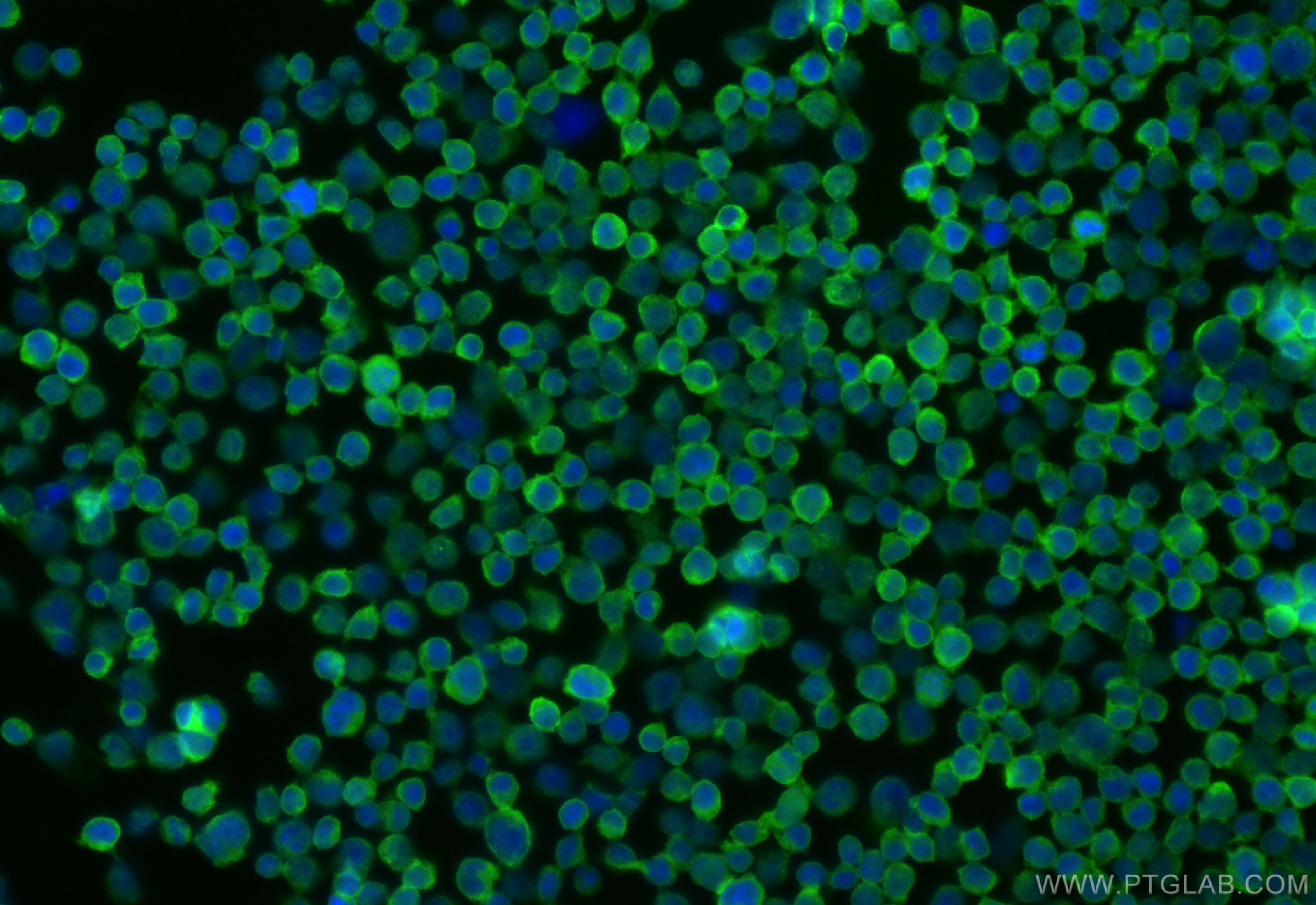 IF Staining of Jurkat using CL488-84904