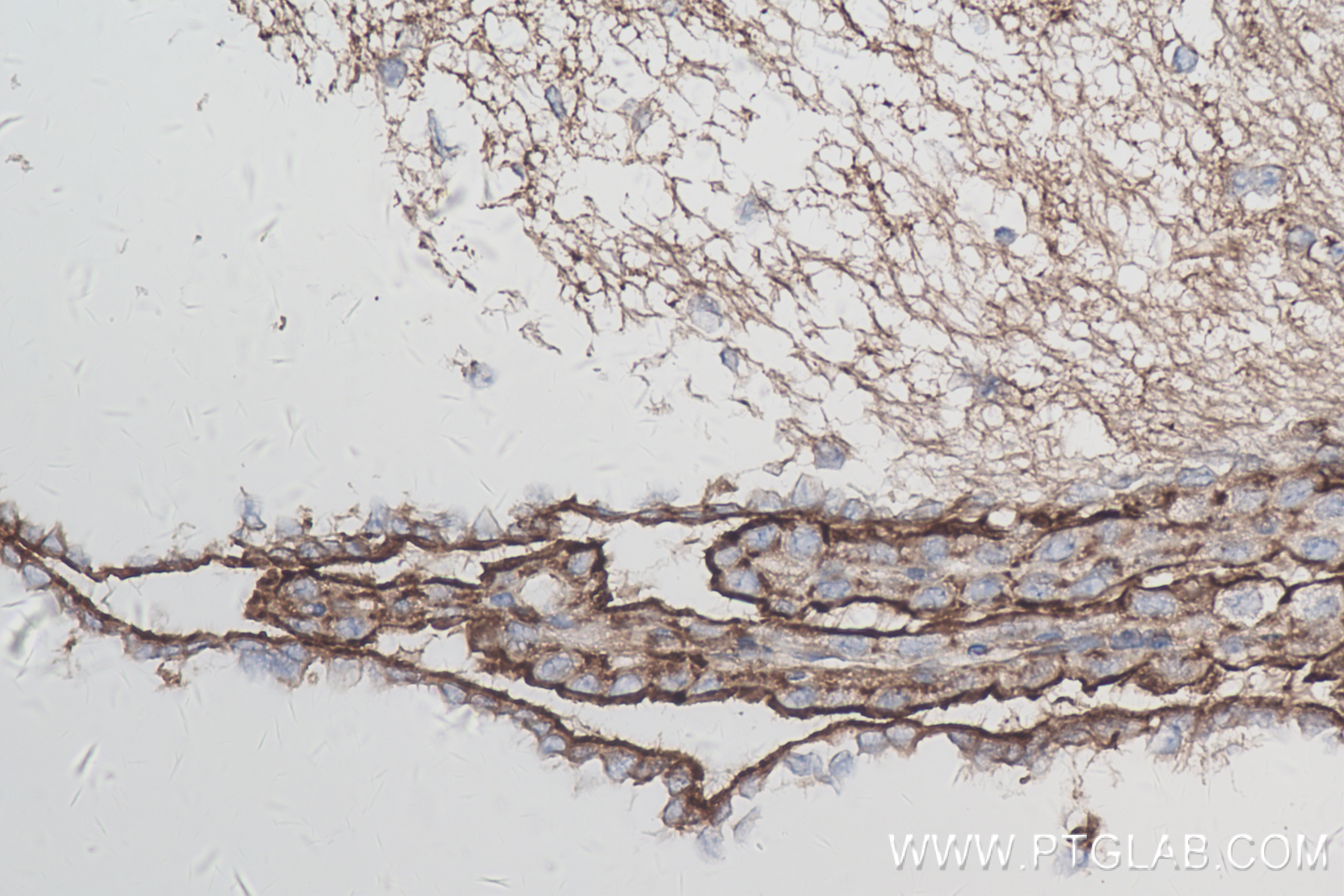 IHC staining of mouse brain using 84591-1-RR