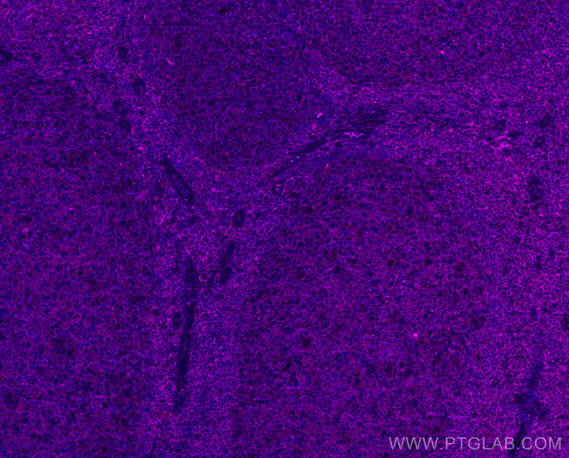 IF Staining of human tonsillitis using APC-84591