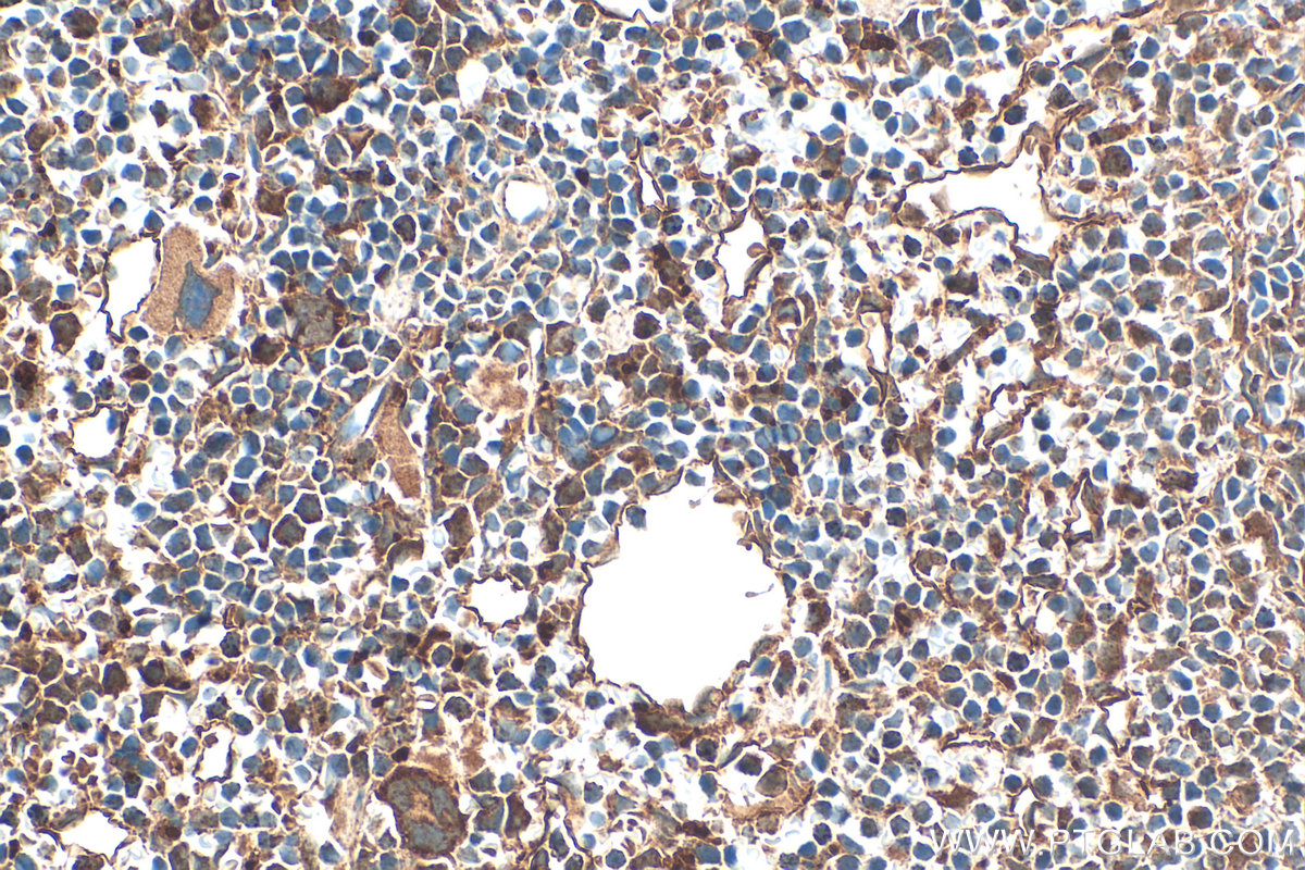 IHC staining of mouse spleen using 20423-1-AP