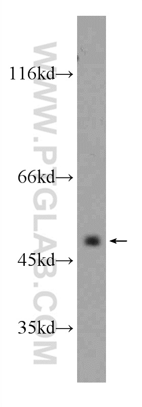CXCR7 Polyclonal antibody