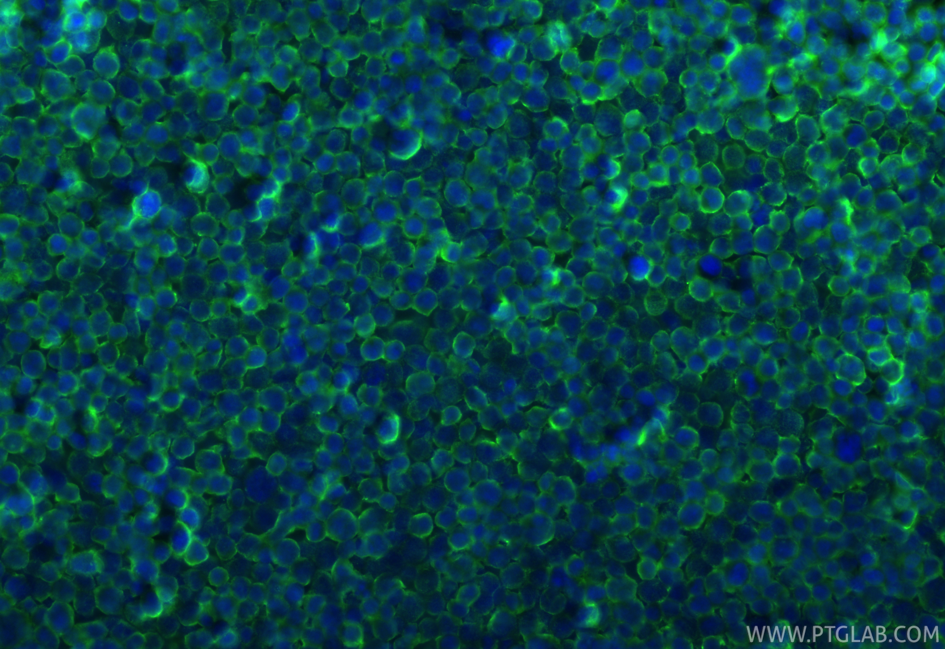 IF Staining of Jurkat using 83927-1-RR
