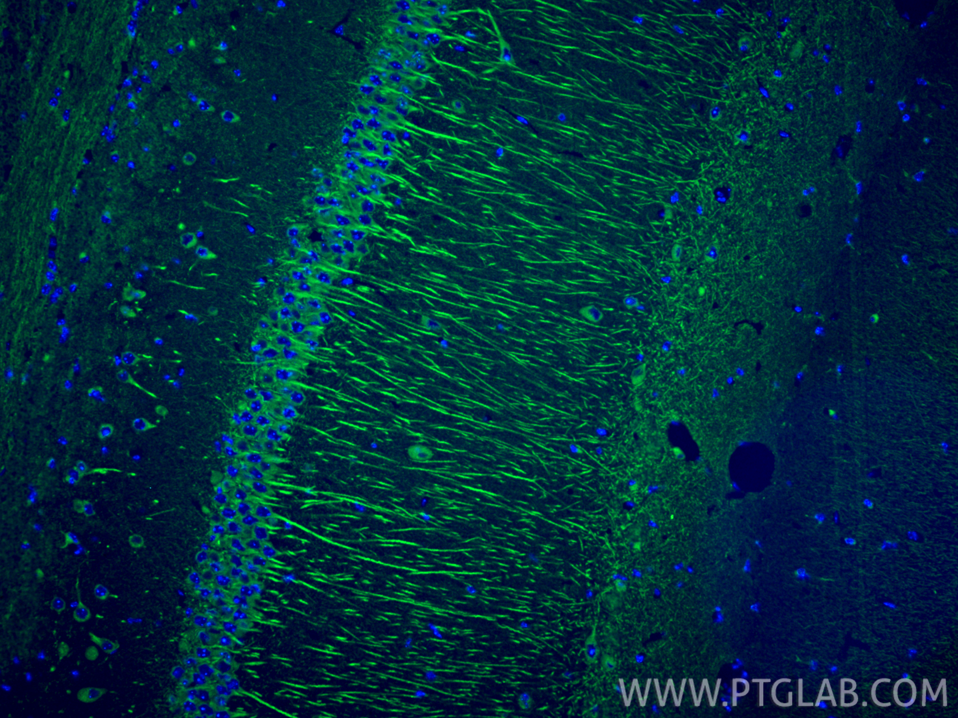 IF Staining of mouse brain using 83927-1-RR