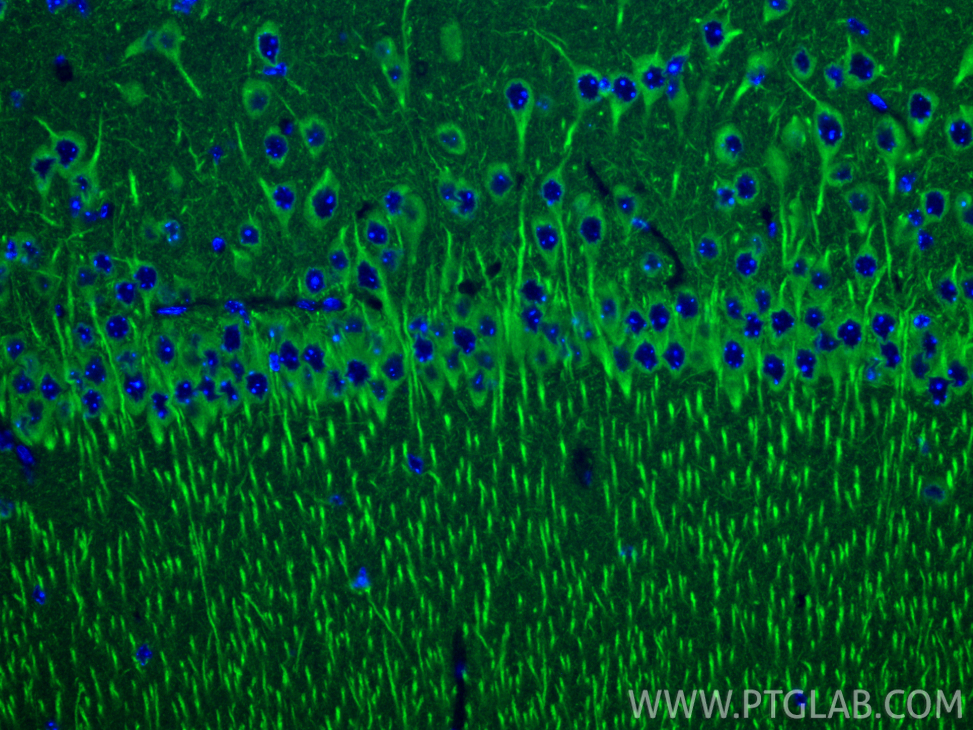 IF Staining of mouse brain using 83927-1-RR