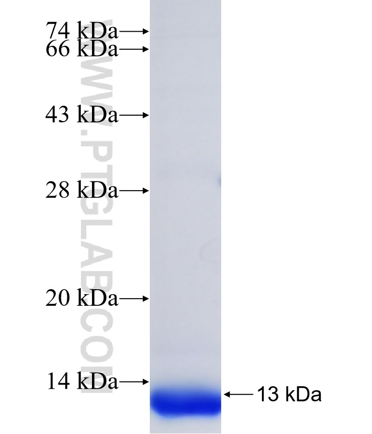 CXCR7 fusion protein Ag34248 SDS-PAGE CXCR7 fusion protein Ag34248 SDS-PAGE