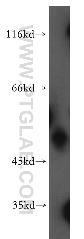 WB analysis of K-562 using 14840-1-AP