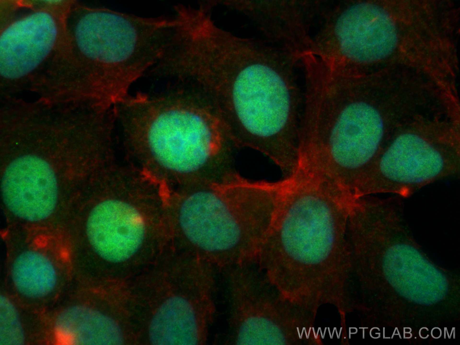 IF Staining of MCF-7 using 16513-1-AP