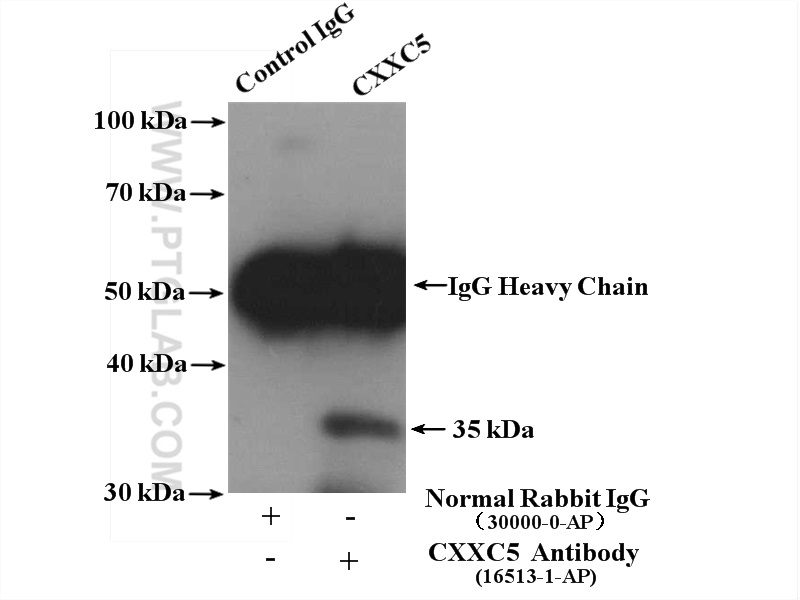 IP experiment of SH-SY5Y using 16513-1-AP