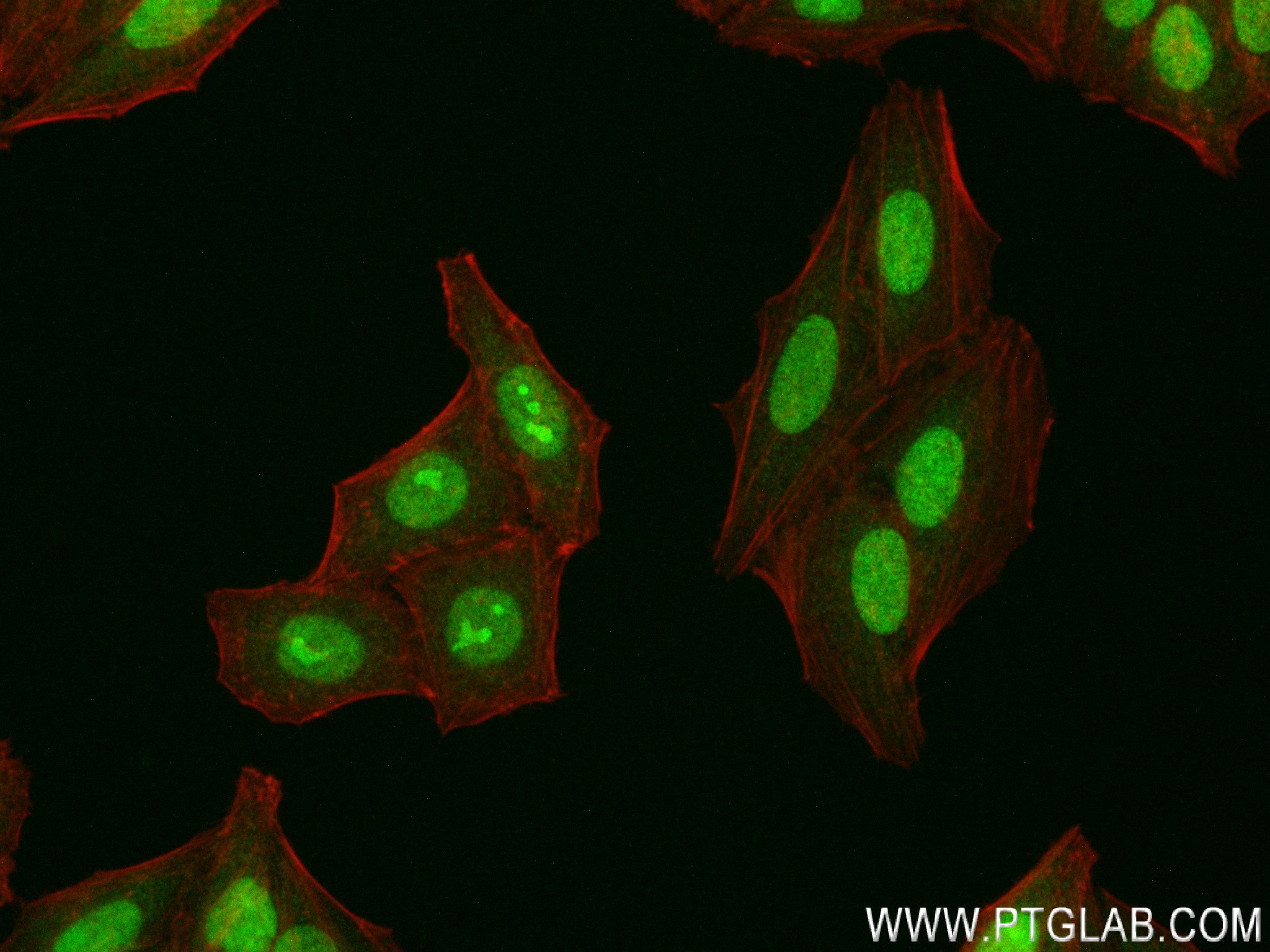 IF Staining of HepG2 using 83940-6-RR (same clone as 83940-6-PBS)