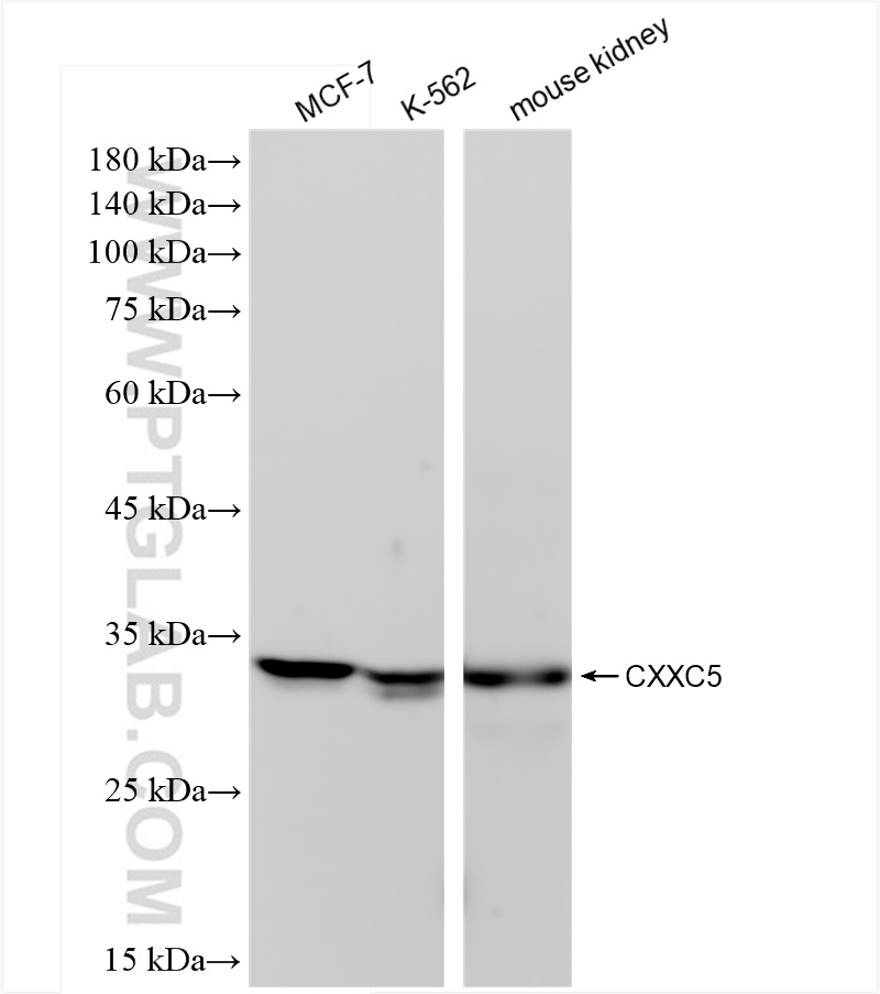 WB analysis using 83940-7-RR (same clone as 83940-7-PBS)