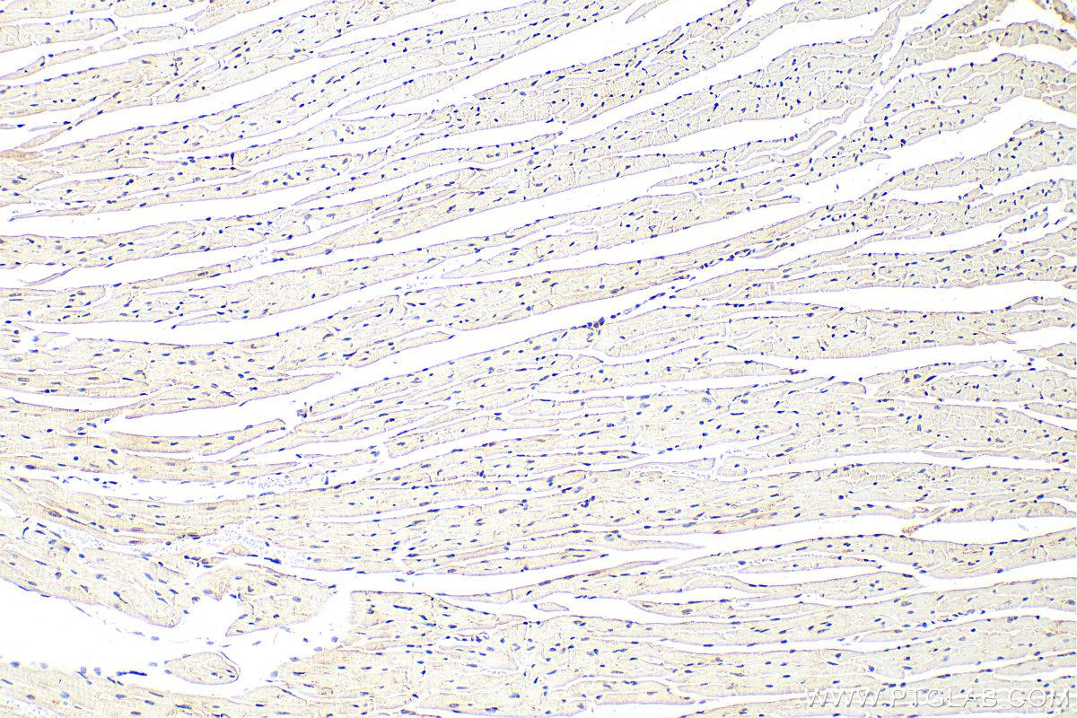 IHC staining of mouse heart using 22357-1-AP