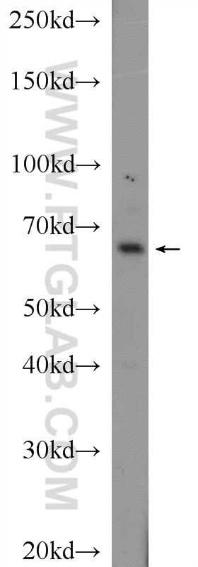 WB analysis of mouse kidney using 22357-1-AP