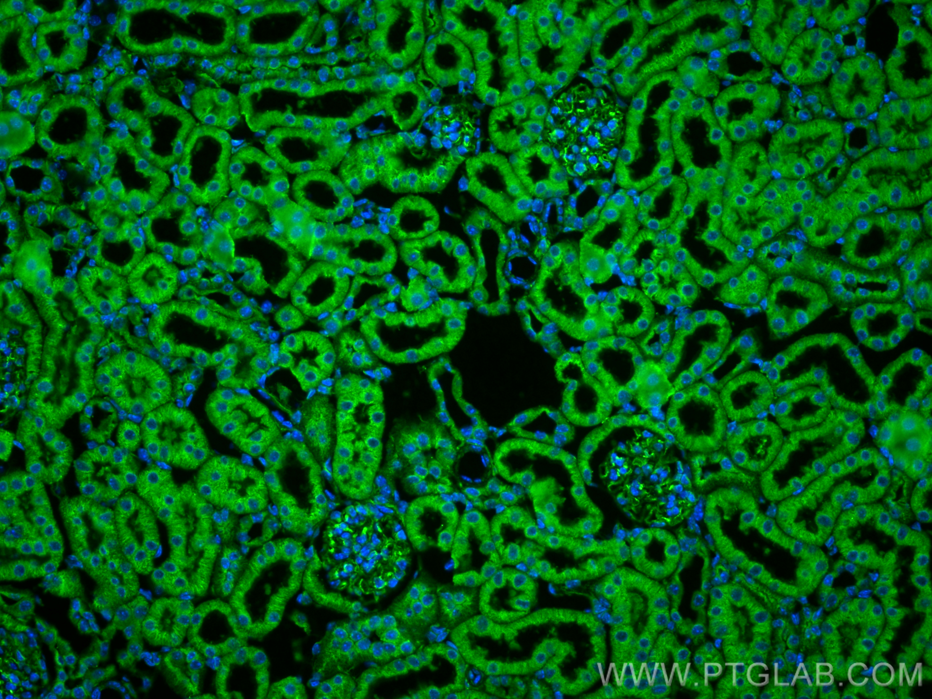 IF Staining of mouse kidney using 20837-1-AP