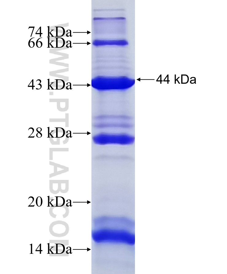 CXorf22 fusion protein Ag15327 SDS-PAGE