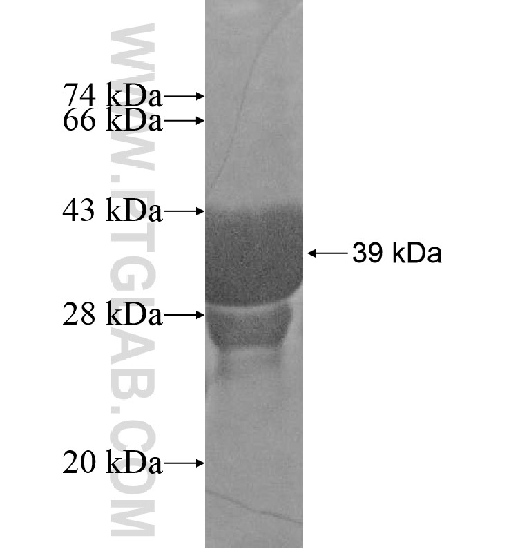 CXorf27 fusion protein Ag16605 SDS-PAGE CXorf27 fusion protein Ag16605 SDS-PAGE