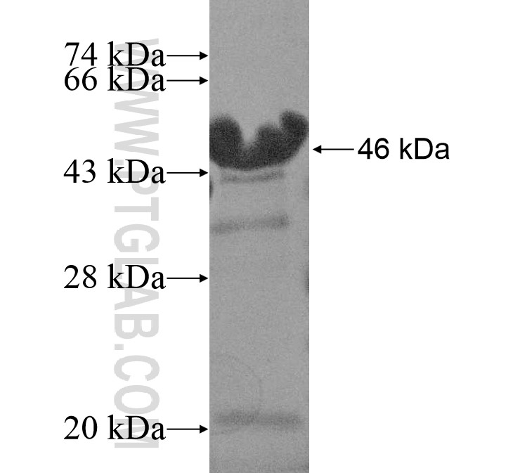 CXorf41 fusion protein Ag15448 SDS-PAGE CXorf41 fusion protein Ag15448 SDS-PAGE