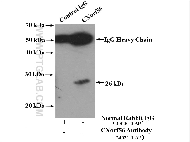 IP experiment of mouse kidney using 24021-1-AP